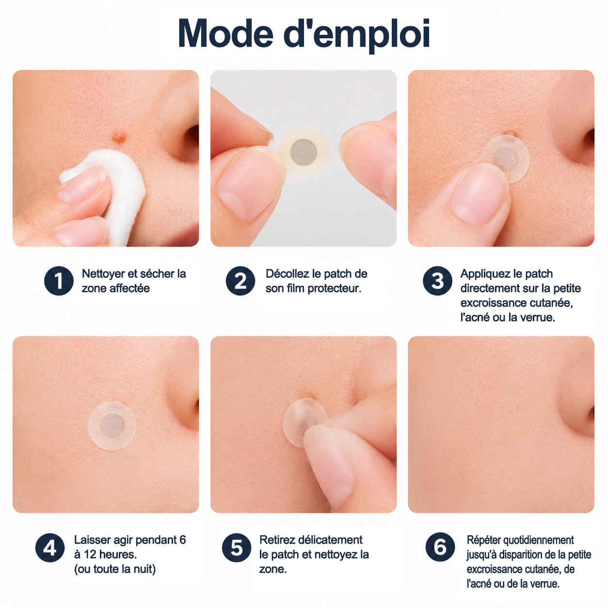 Curalona® Patchs Micro-Aiguilles & Hydrocolloïdes 2-en-1  | Cible les imperfections, verrues planes et acrochordons | Invisible • Facile à utiliser • Visage & Corps