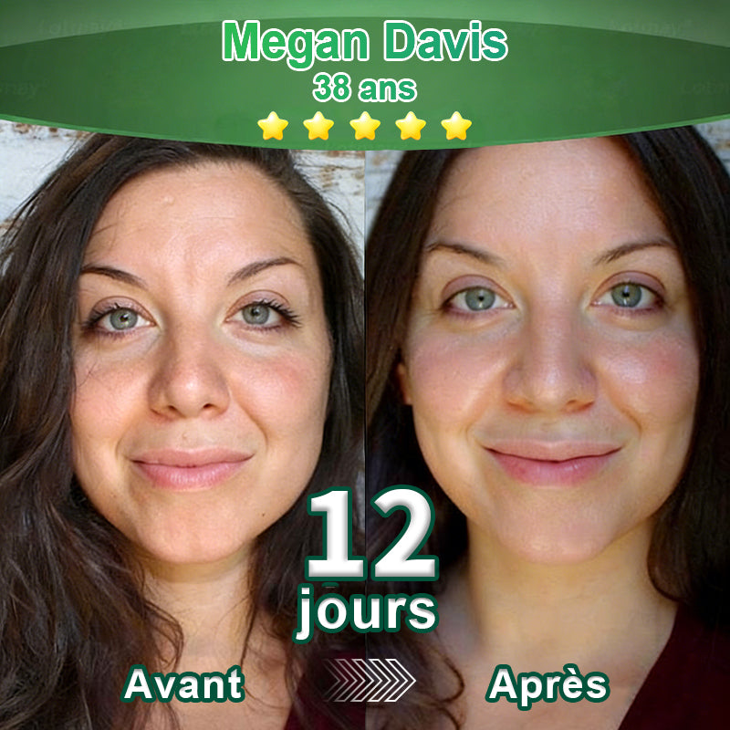 Changez de l’intérieur vers l’extérieur | ✨ Purelora® Sérum Activateur EGF & Peptides de Cuivre dérivés de cellules souches (Active intensément le renouvellement cutané pour une peau plus ferme et plus lisse)