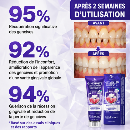 EdiJonah® VioCore [ Dentifrice de soin dentaire au venin d’abeille ]