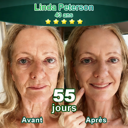 Changez de l’intérieur vers l’extérieur | ✨ Purelora® Sérum Activateur EGF & Peptides de Cuivre dérivés de cellules souches (Active intensément le renouvellement cutané pour une peau plus ferme et plus lisse)